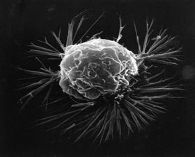 genome cancer